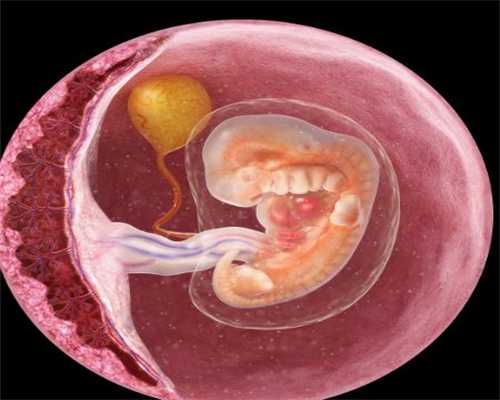 代孕不孕咨询_孕期谨慎五种子宫问题