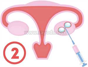昆明助孕网昆明代生子服务-_人工助孕是什么意思_如何怀孕助孕