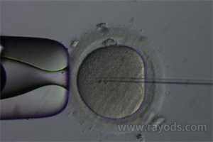 昆明助孕网昆明代生子服务-_人工助孕是什么意思_如何怀孕助孕