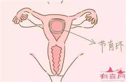 什么是生殖助孕_助孕公司_中国有代孕医院吗